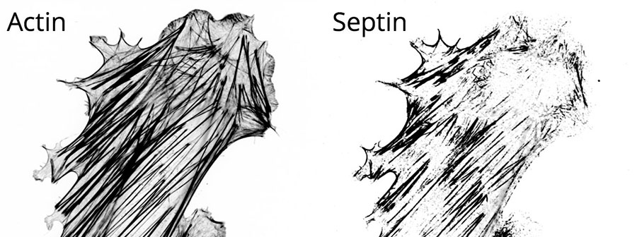An immunofluorescence image of a 3T3 fibroblast stained for two cytoskeletal filaments: actin (left) and septin (right).
